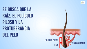 Foliculo Piloso