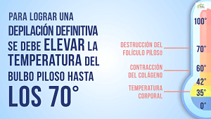 Eliminación del Bulbo Piloso