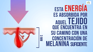La energía es absorbida por la melanina