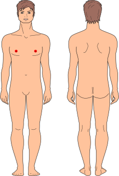 Areolas