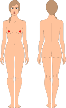 Areolas