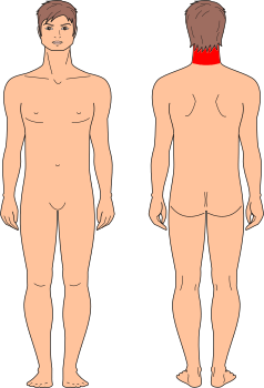 Cuello Posterior
