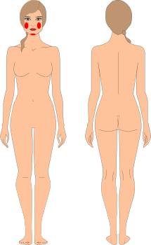 Mejillas y Mentón