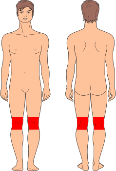 Rodillas