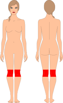Rodillas